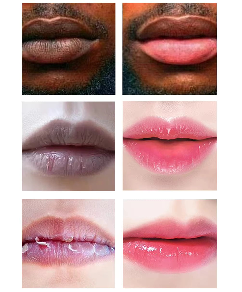 Anti Smoke Lip Lightening Scrub Balsem