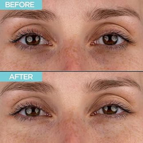 Micro needling serum eye patches