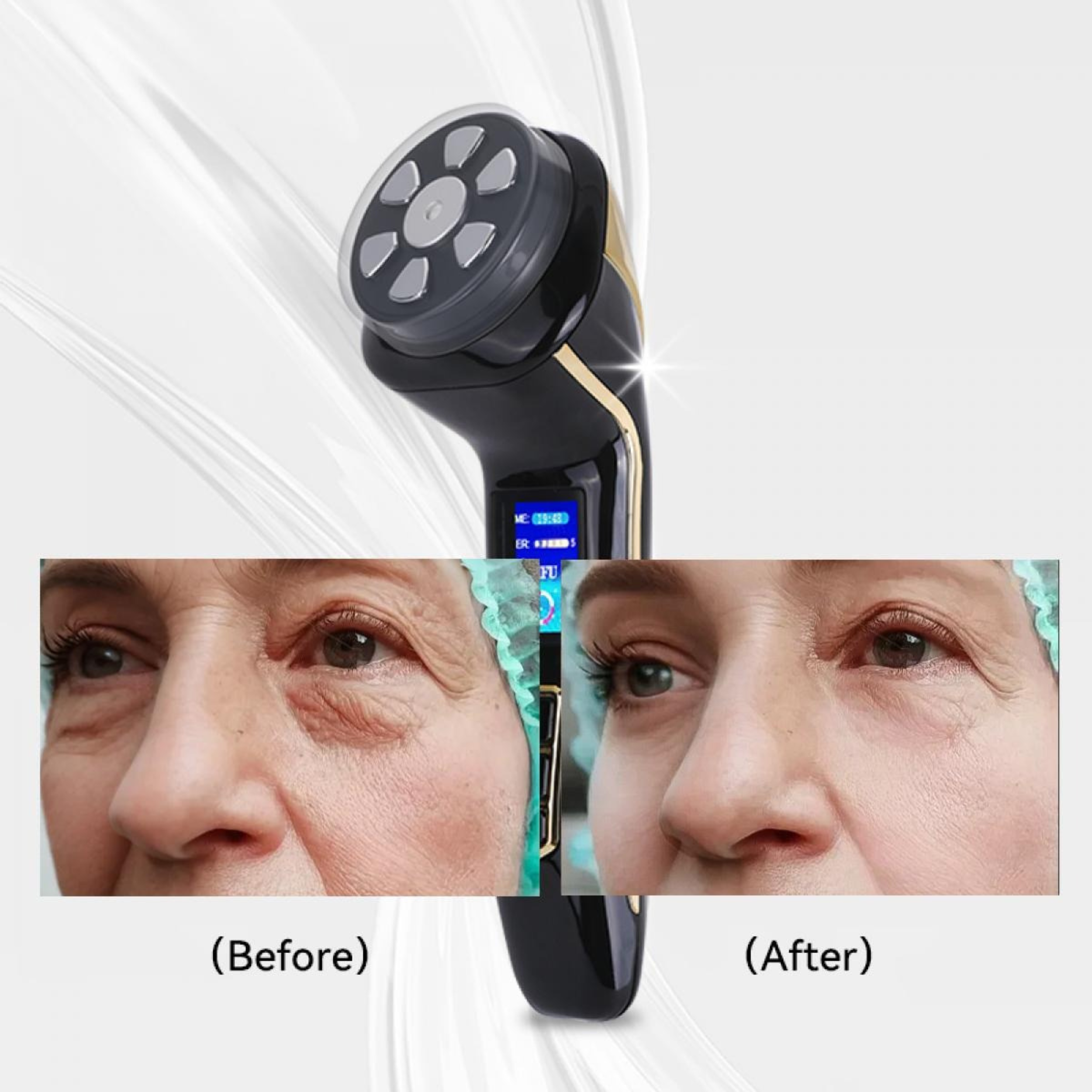FacialDefy Pro 2.0