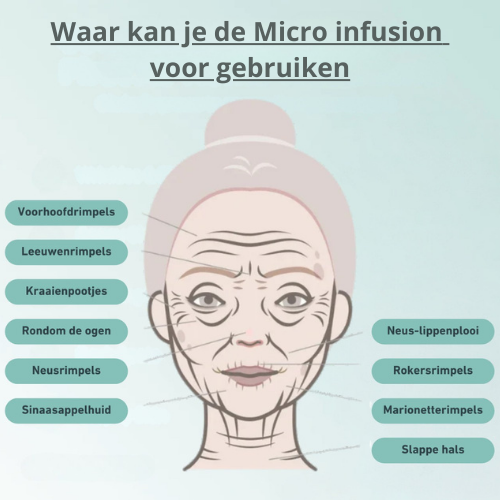 Microneedle infusion