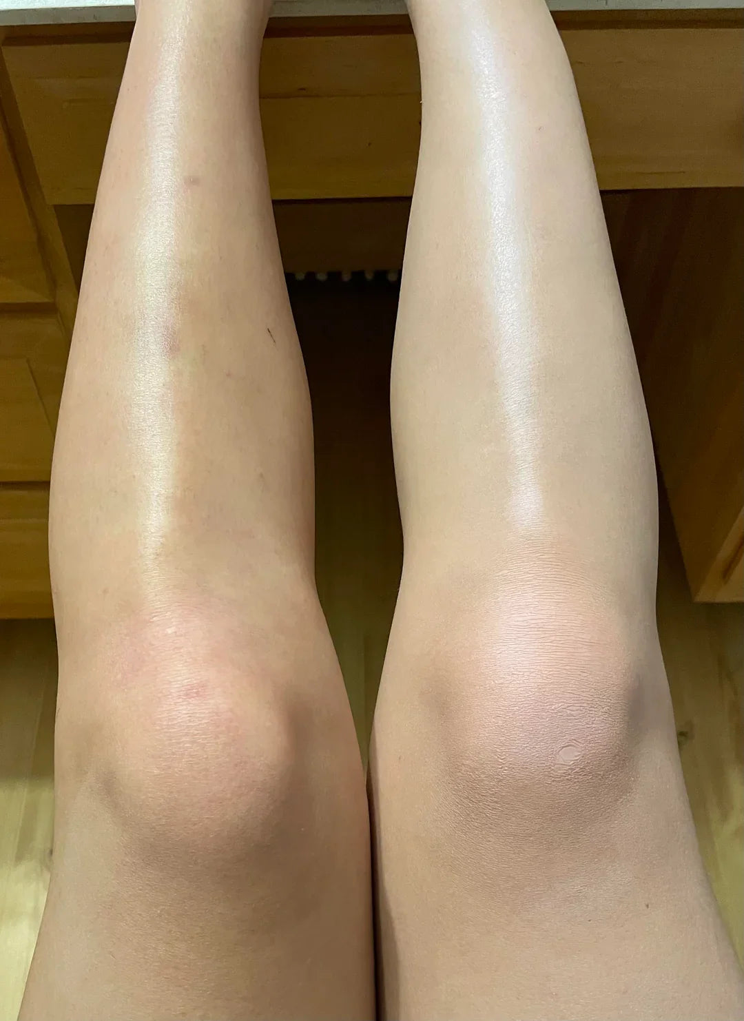 Bodyskin Perfection
