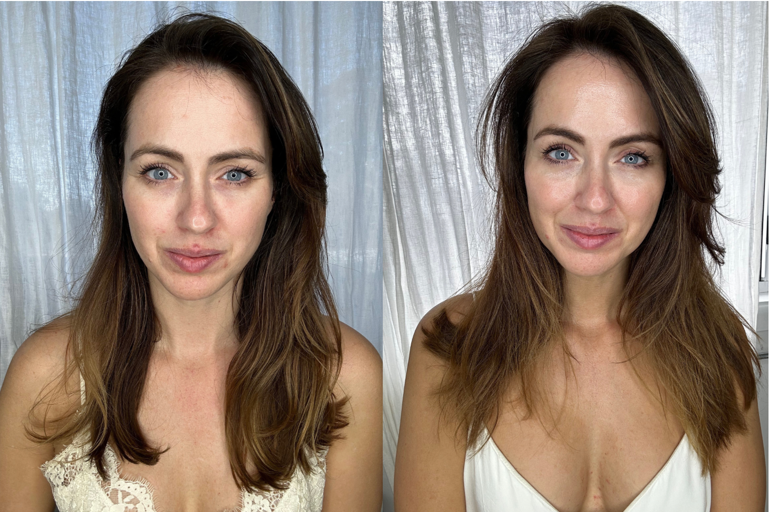 Microneedle infusion