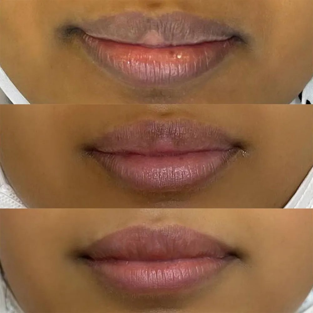 Anti Smoke Lip Lightening Scrub Balsem